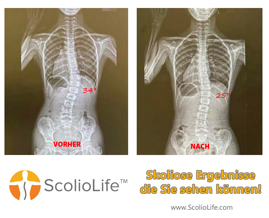 Xrays before and after 114