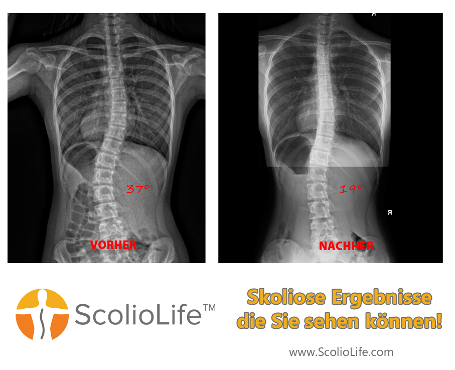 Xrays before and after 115