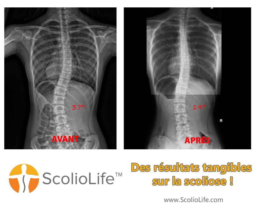 Xrays before and after 114