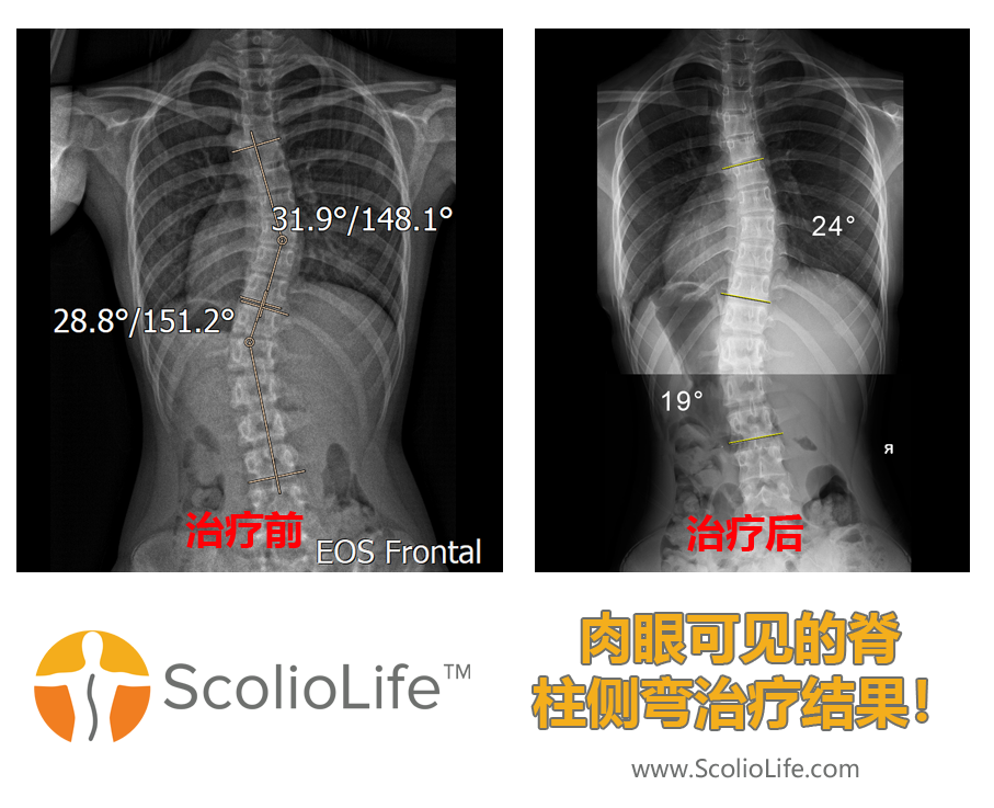 Xrays before and after 127