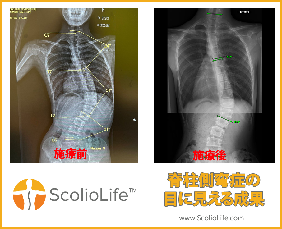 Xrays-before-and-after-132