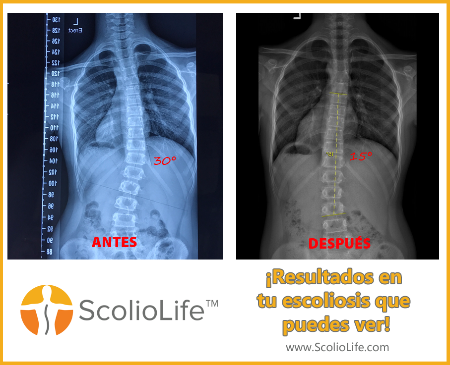 Xrays-before-and-after-132